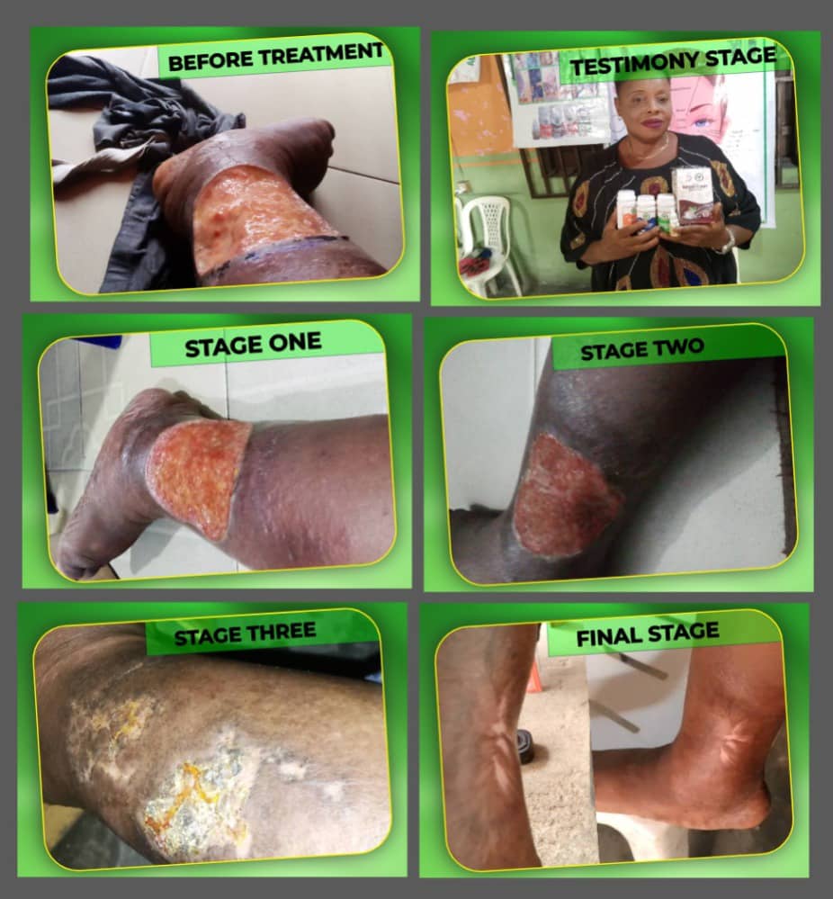 Leg-Healing-Testy-1.jpeg