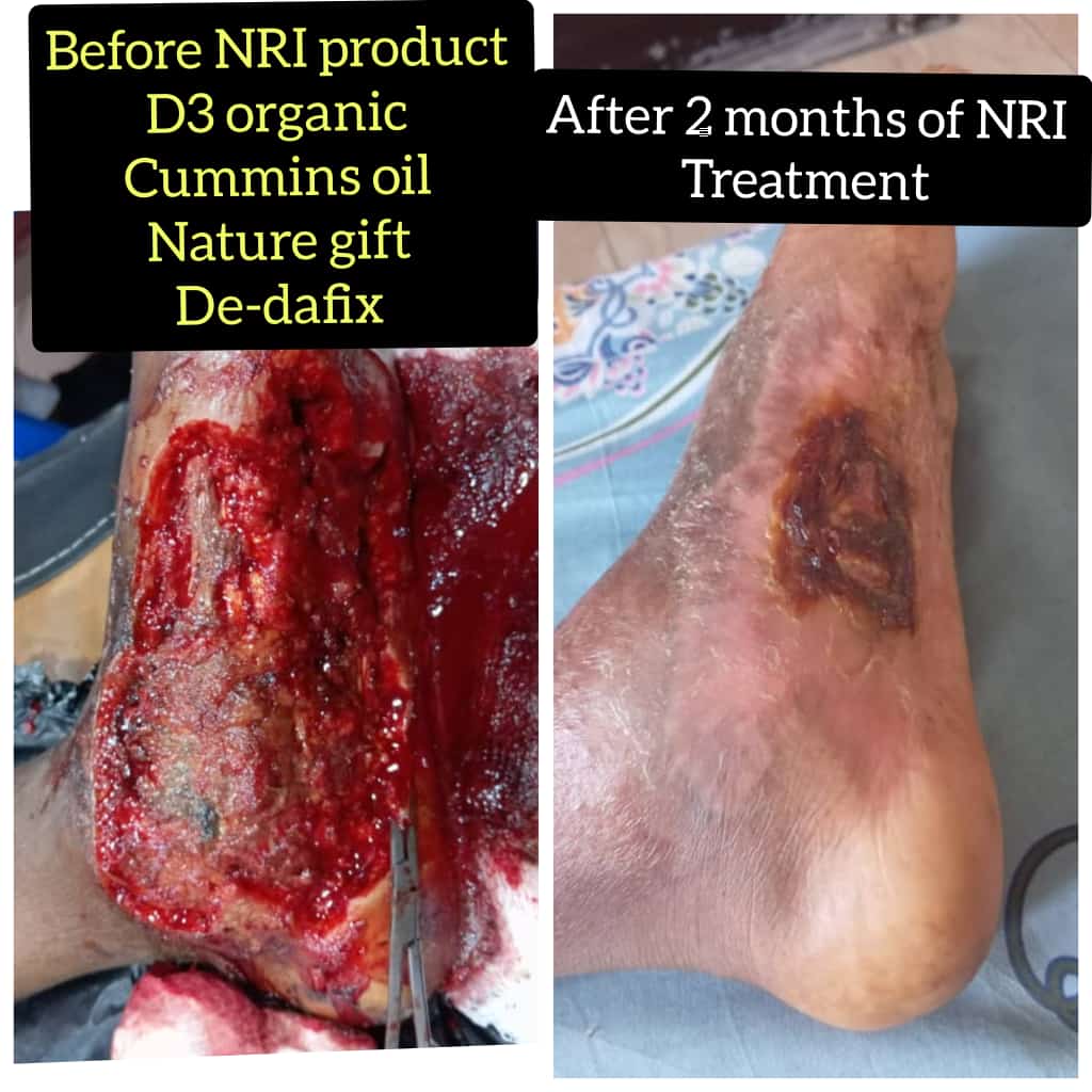 Wound-Healing-1.jpeg